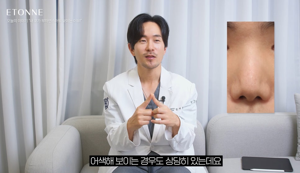 [Etone TV] Why a surgically enhanced nose can look unnatural image 6