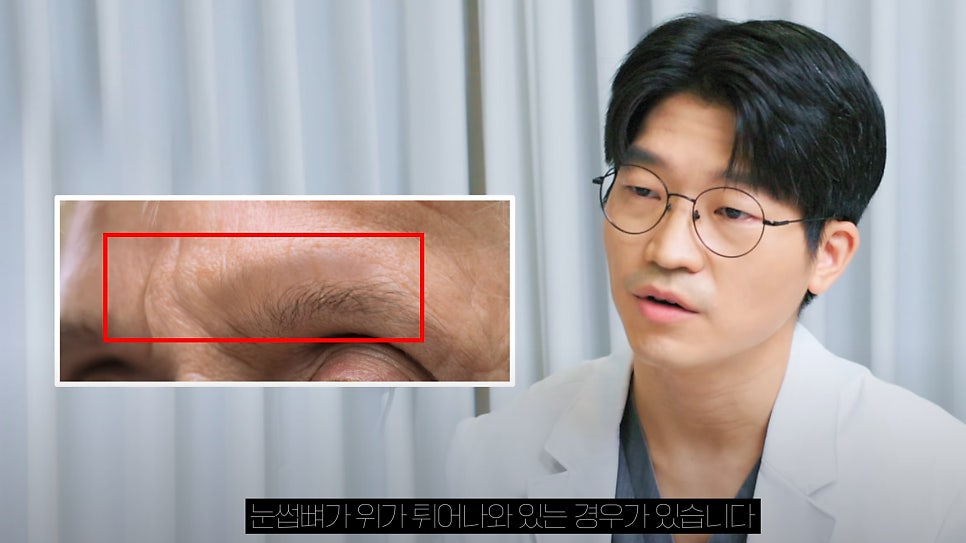 [Eton TV] Worried About Forehead Wrinkles? From Surgery to Procedures! image 4