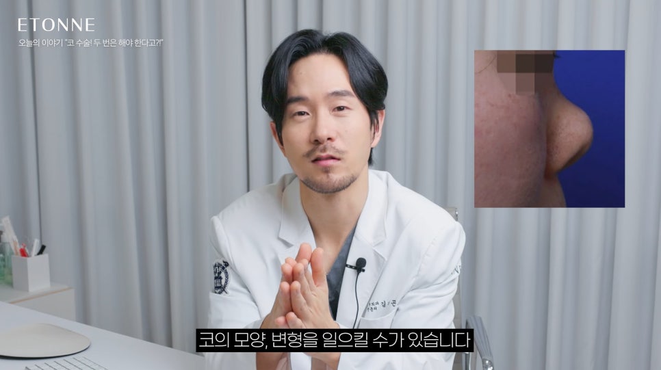 [에톤TV] 코 성형, 두 번 안해도 되는 방법이 있습니다! 관련 이미지 2