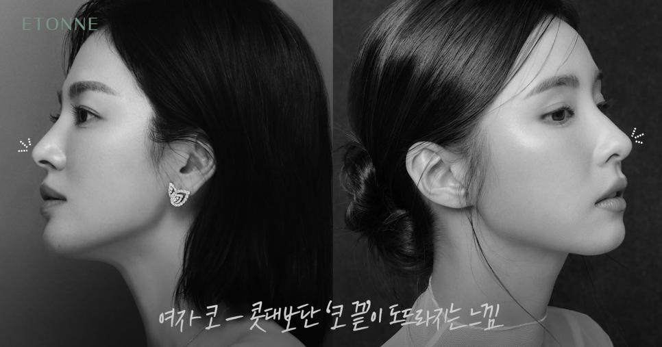 [에톤TV] 남자 vs 여자, 코 성형의 핵심! 콧대와 코끝의 중요성 관련 이미지 6