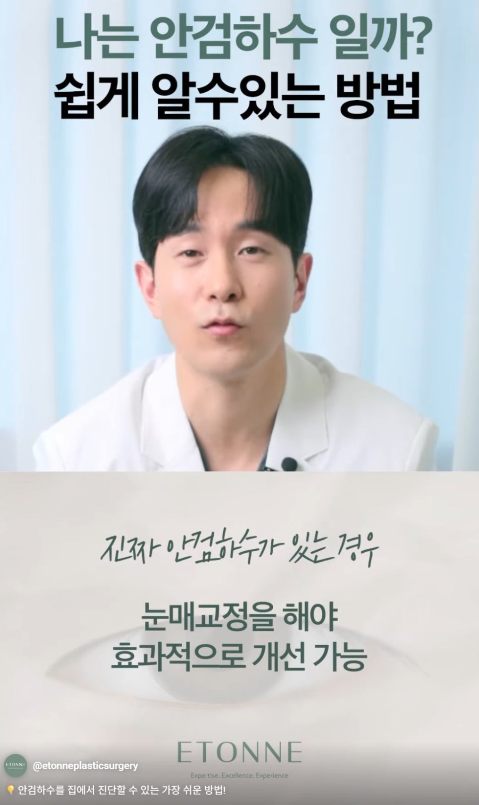 [에톤TV] 안검하수를 진단하는 가장 쉬운 방법 관련 이미지 7