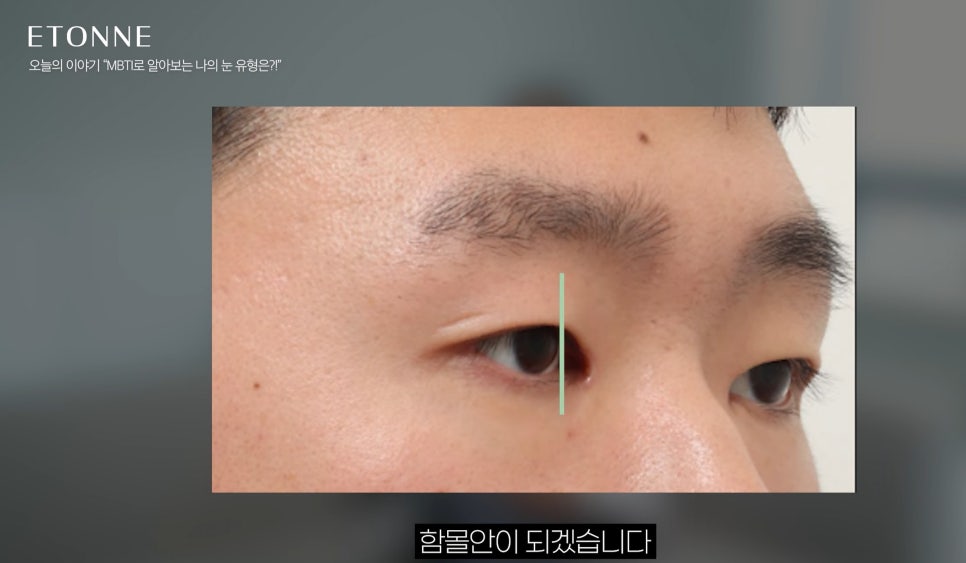 [에톤TV] What Is My Eye Type According to Eye MBTI? image 4