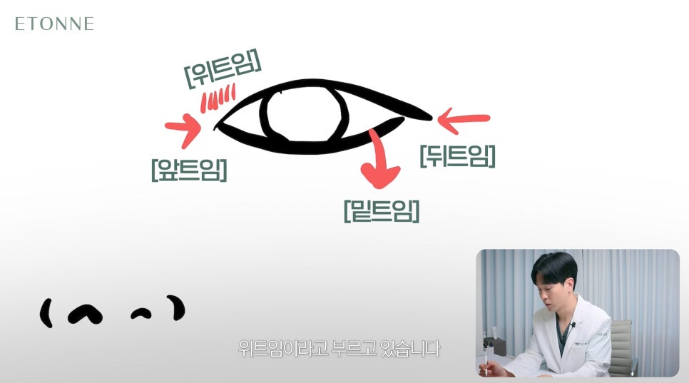 [에톤TV] 트임성형의 종류와 부작용 관련 이미지 3