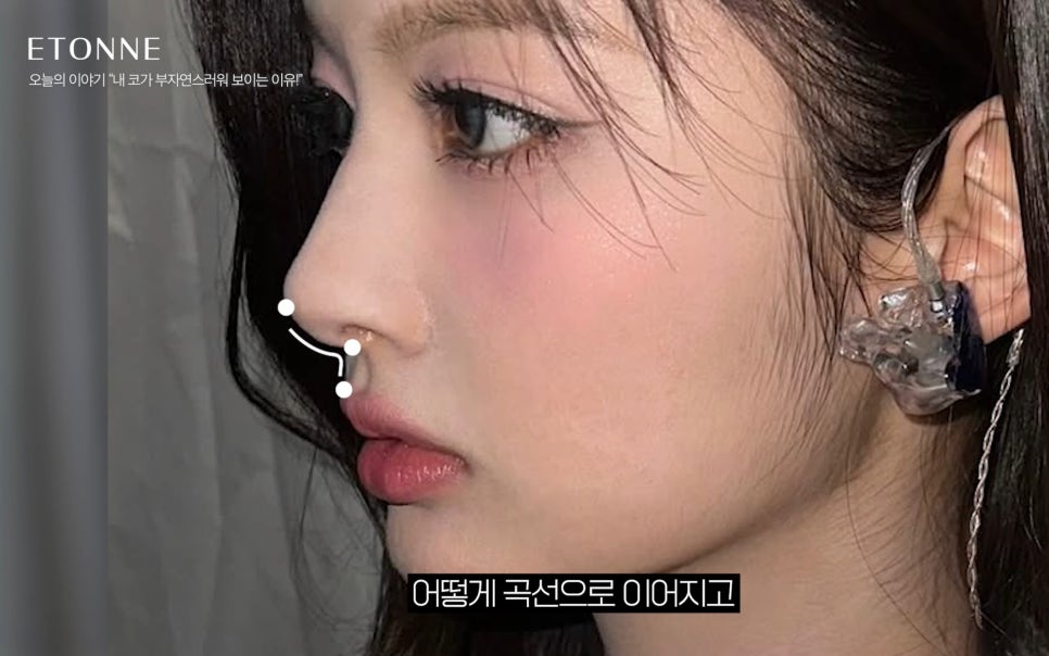 [Etone TV] Why a surgically enhanced nose can look unnatural image 2