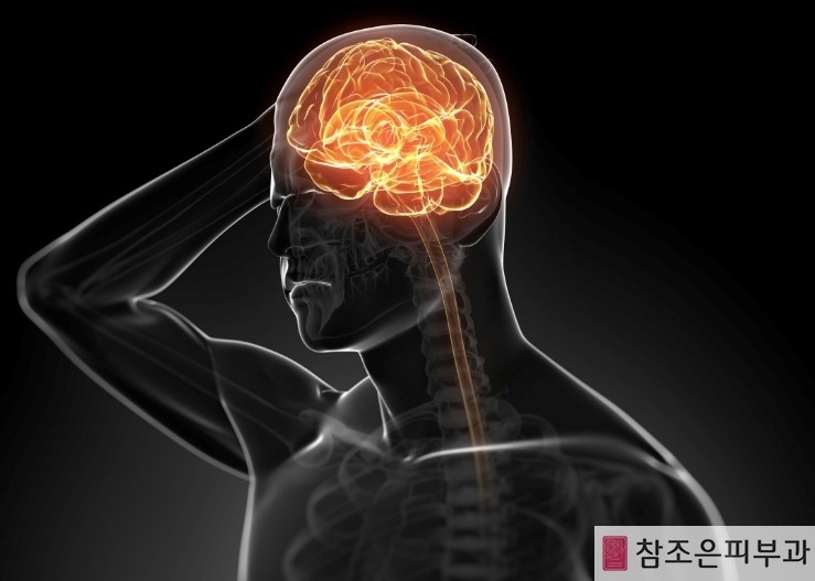 명절이 지난후 대상포진이 많아진다는데 그 이유는? - [영등포 당산역 참조은피부과] 관련 이미지 6