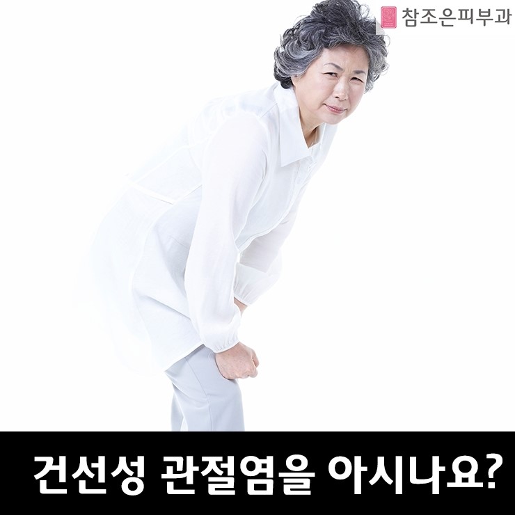 건선의 동반성질환 건선성 관절염 알고 계신가요? - 영등포 참조은피부과 관련 이미지 1
