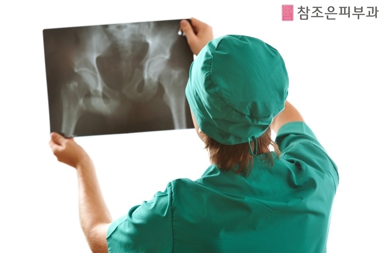 건선의 동반성질환 건선성 관절염 알고 계신가요? - 영등포 참조은피부과 관련 이미지 5