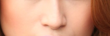촌년병 안명홍조증 치료 어떻게 할까요? 관련 이미지 4