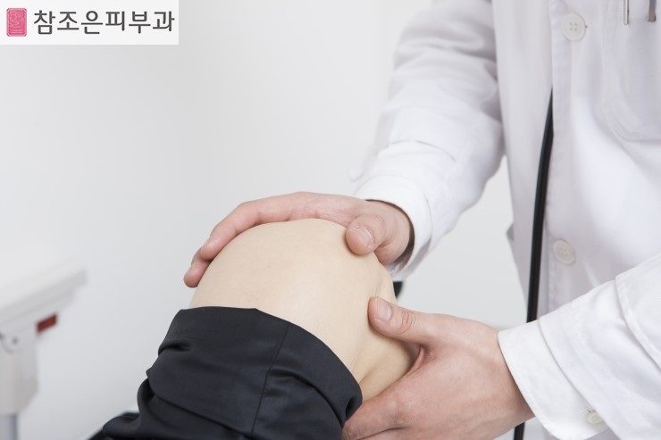 건선의 동반성질환 건선성 관절염 알고 계신가요? - 영등포 참조은피부과 관련 이미지 2