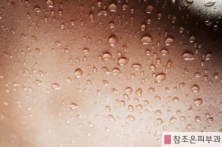 극심한 고통 대상포진의 증상 - 영등포 대상포진치료 참조은피부과 관련 이미지 1