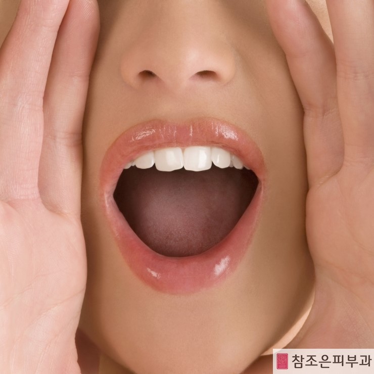 입술화장 아름답게 하는 비법 - 영등포 입술문신 참조은피부과 관련 이미지 7