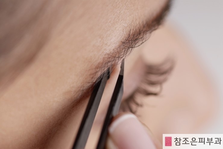 안전한 반영구화장을 하기 위해 알아야 할 것 - 당산역 참조은피부과 관련 이미지 2