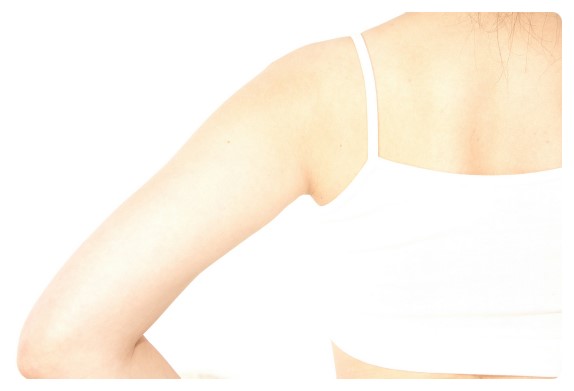 [당산동피부과]접촉성 피부염(contact dermatitis) 제대로 알고 치료하자!! 관련 이미지 4