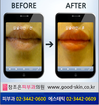 [ 당산동반영구클리닉] 입술라인 살리는방법!! 관련 이미지 4