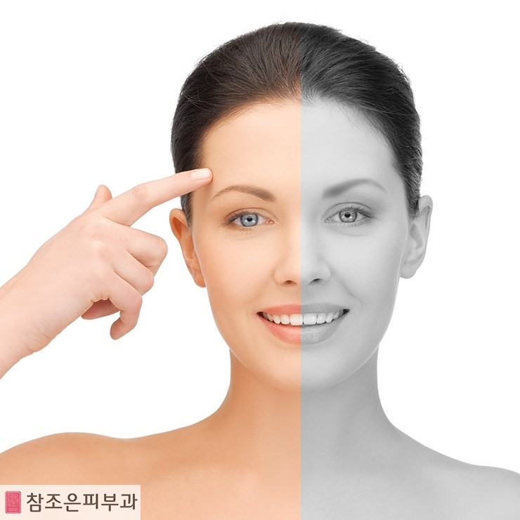 영등포 당산역 반영구화장 잘하는 곳 - 당산동 참조은피부과 관련 이미지 2