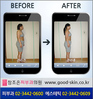 [당산동전신관리] 예쁜몸매 갖기위한 전신관리!! 관련 이미지 4