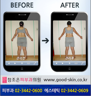 [당산동전신관리] 예쁜몸매 갖기위한 전신관리!! 관련 이미지 3