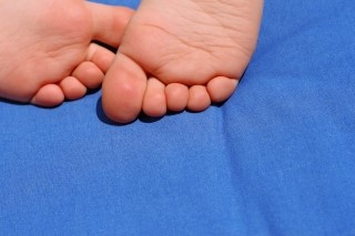 [ 당산티눈치료 ] 티눈 제거하기!! 관련 이미지 3