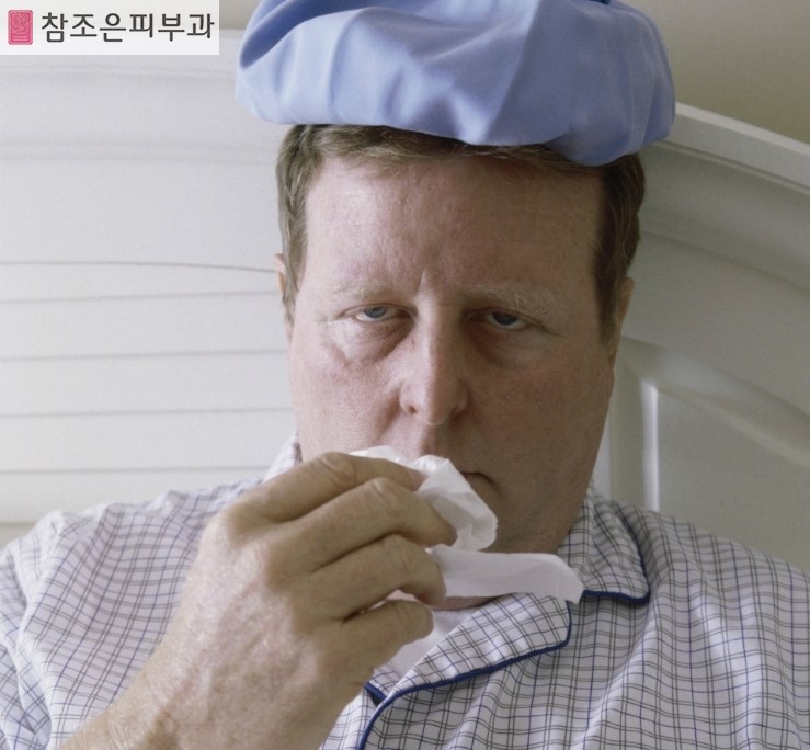 감기 몸살과 증상이 비슷한 대상포진 진단법 - 영등포 당산피부과 참조은피부과 관련 이미지 2