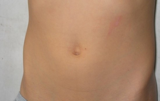 홀쭉한 배 만들기 복부관리를 소개합니다. 관련 이미지 4
