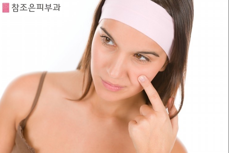 양평동피부과 - 참조은피부과에서 알아보는 여드름의 증상과 예방법 관련 이미지 3