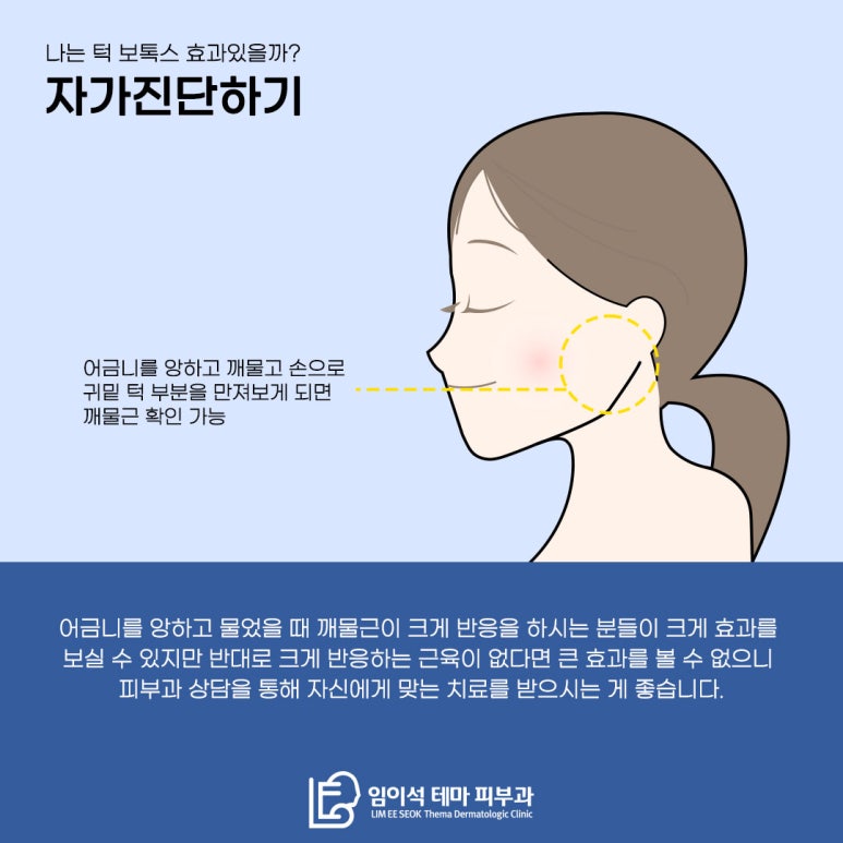 임이석테마피부과에서 알려드리는 턱 보톡스 관련 이미지 5