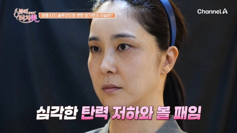 채널A 뷰티클리닉 터치미 5회~8회 사례로 알아보는 피부를 망치는 습관 모음집 [신사역 임이석테마피부과] 관련 이미지 1