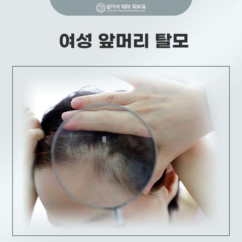 Why Women Worrying About Hairline Hair Loss Should Choose Imiseok Theme Dermatology, Sinsa-dong Hair Loss Clinic image 2
