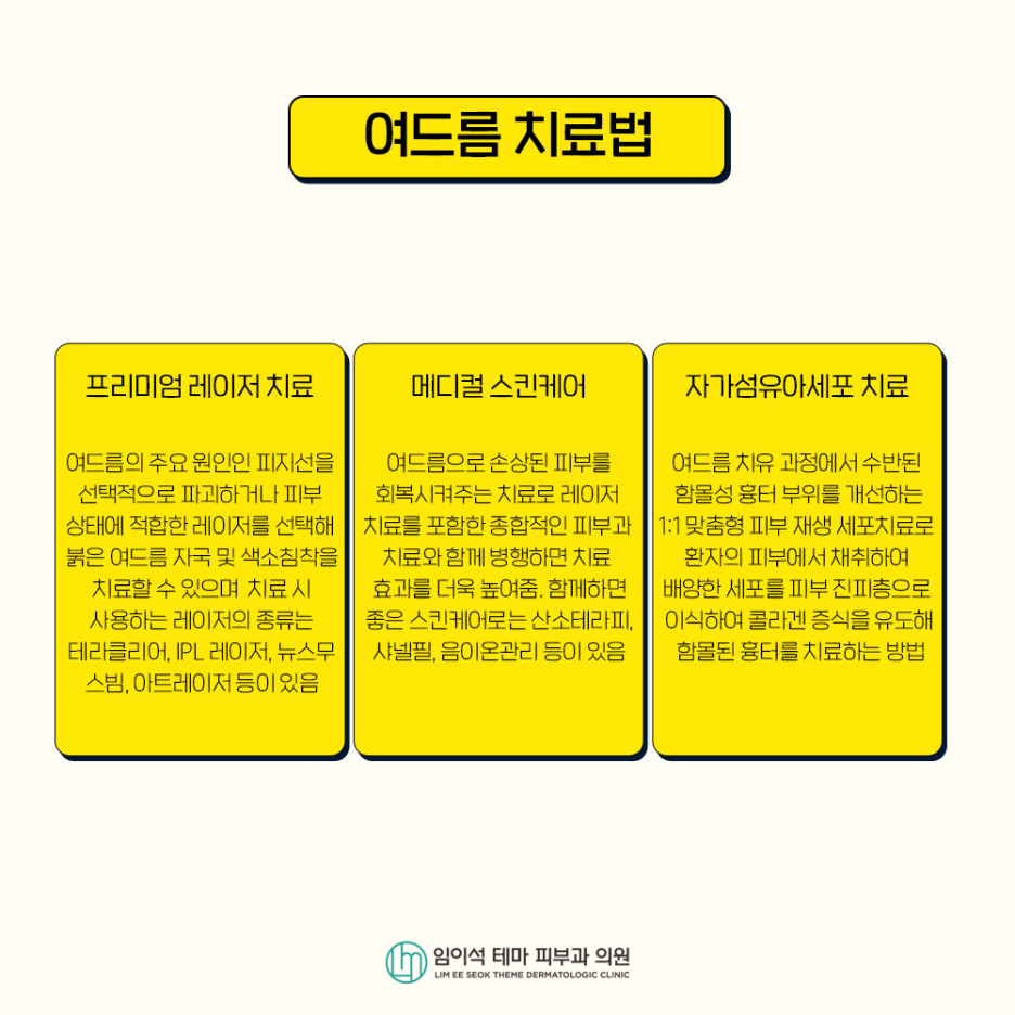 여드름의 종류, 원인, 치료, 흉터 관리법 관련 이미지 7