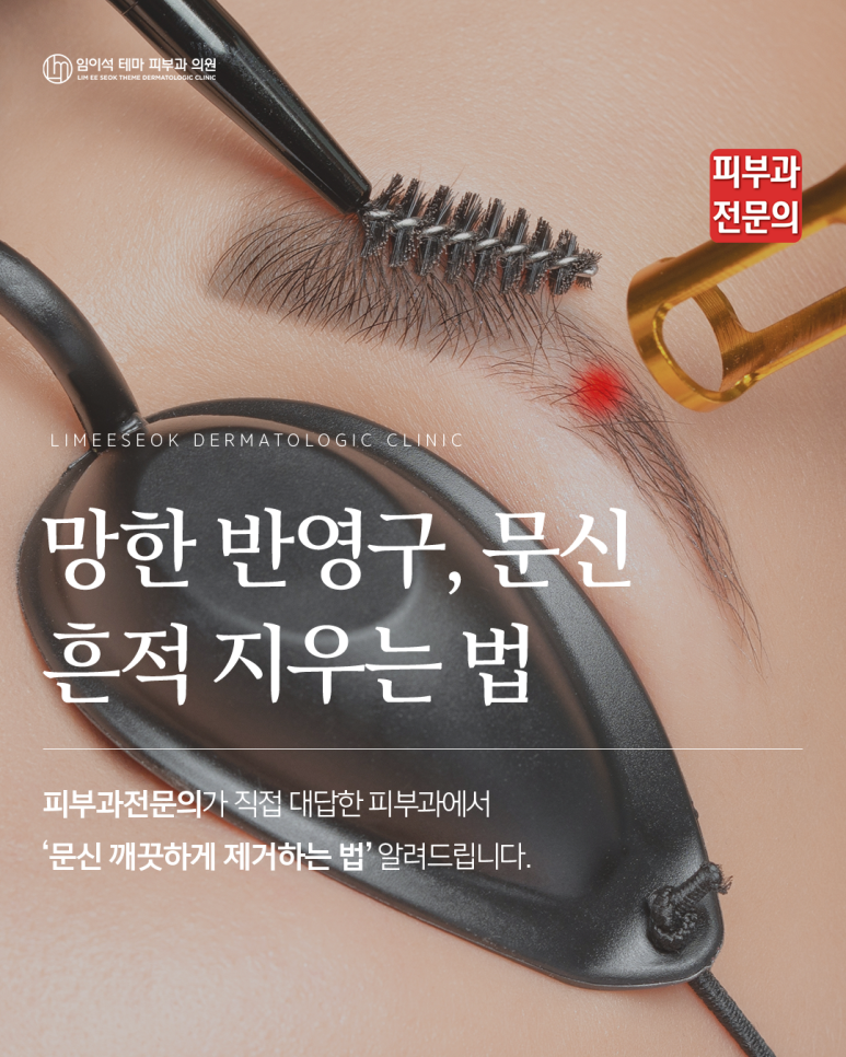 신사역피부과추천, 유행지난 반영구&middot;문신제거 방법은? 관련 이미지 1