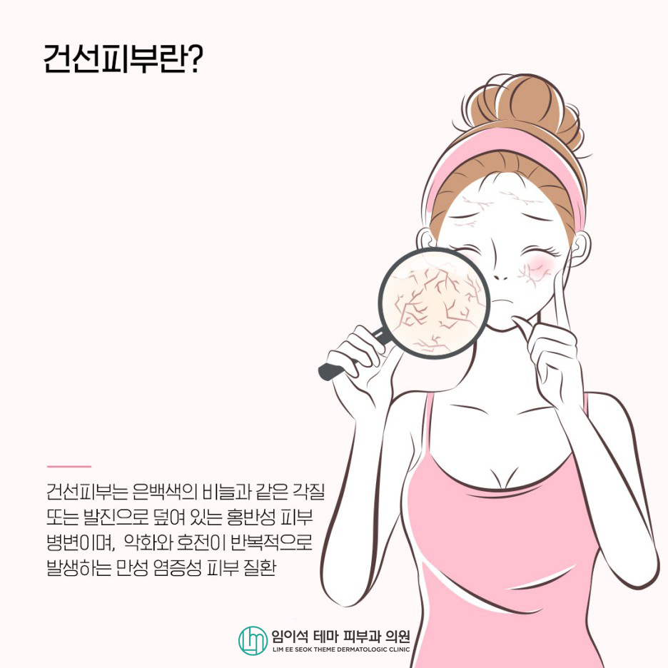 Why Dry Skin and Psoriasis Occur, and How They Are Treated image 3