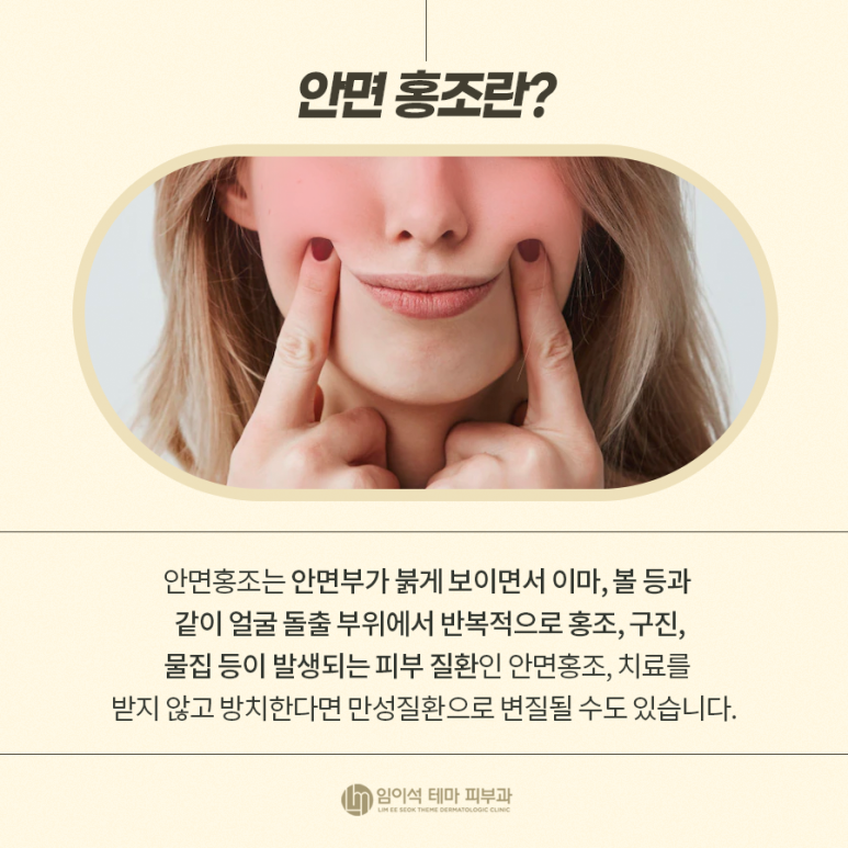 Red Face image 3