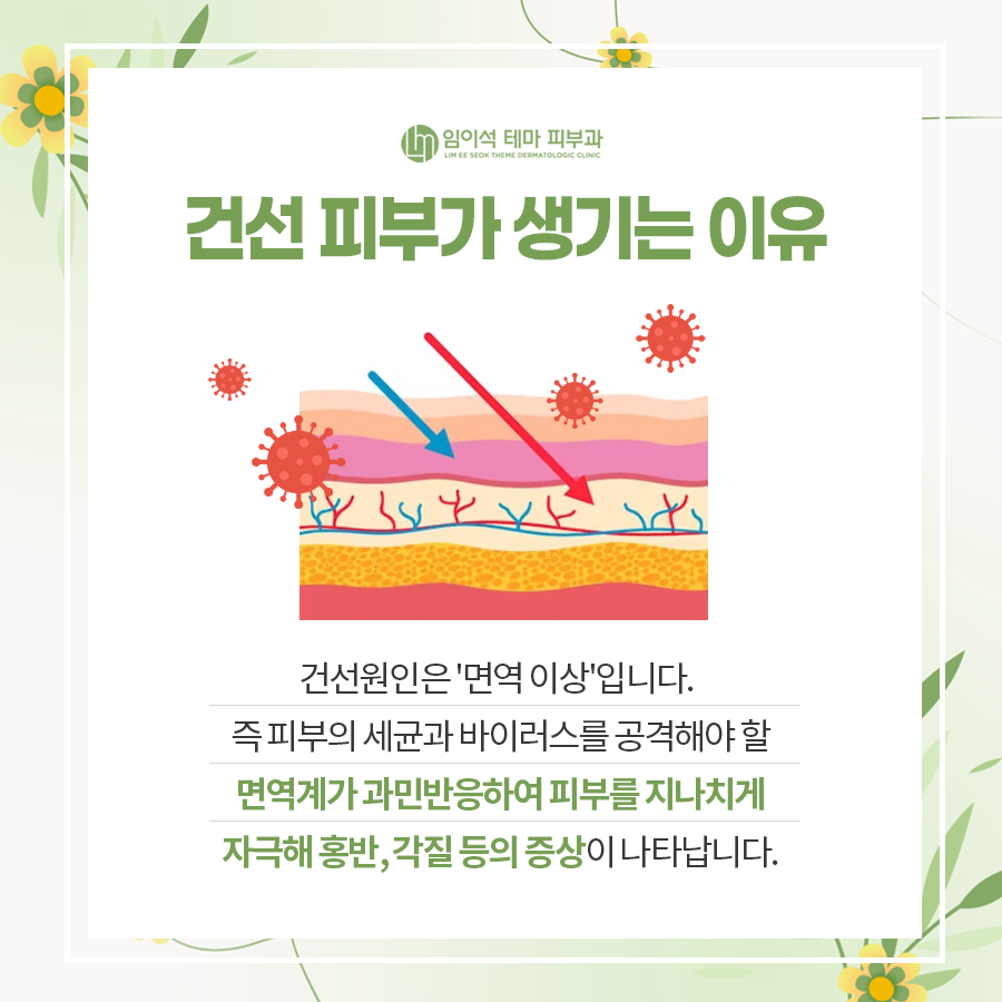 건조한 피부, 피부 건선이 생기는 이유와 치료 방법 관련 이미지 4