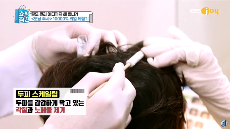 KBS Joy Shopping’s Pointers <A Full Breakdown of Anti-Hair-Loss Items> image 6