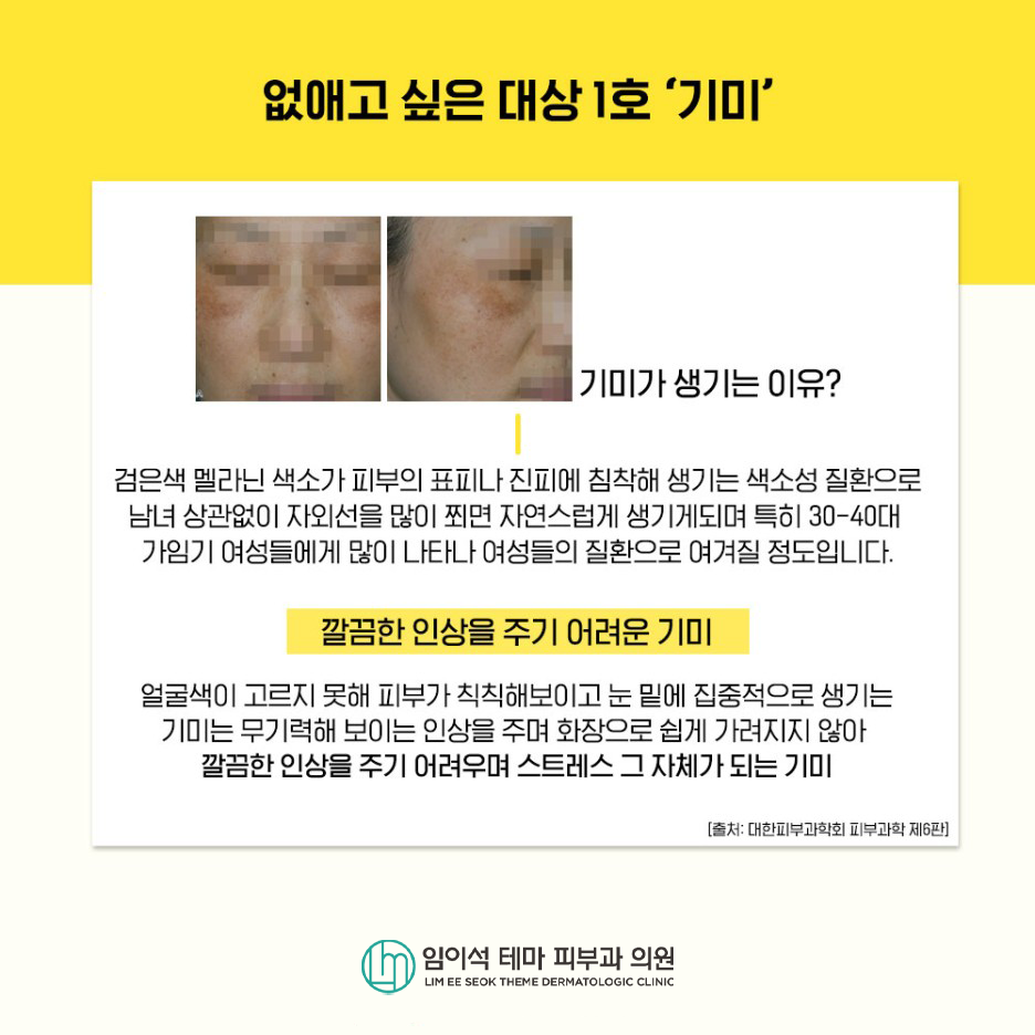 깨끗한 피부를 위한 기미잡티 색소질환치료와 관리법 관련 이미지 3