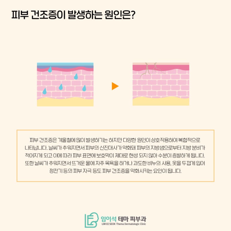 임이석테마피부과에서 알려드리는 피부건조증 관련 이미지 4