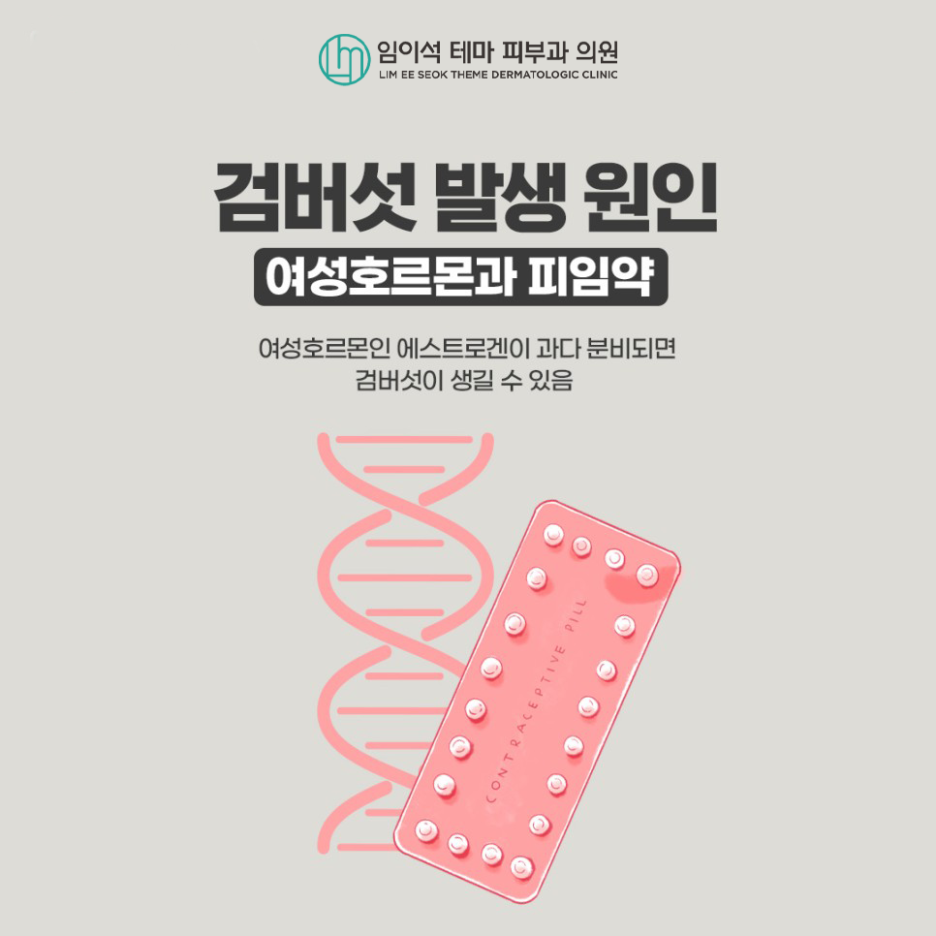 레이저를 이용한 검버섯 치료방법과 예방법 관련 이미지 6