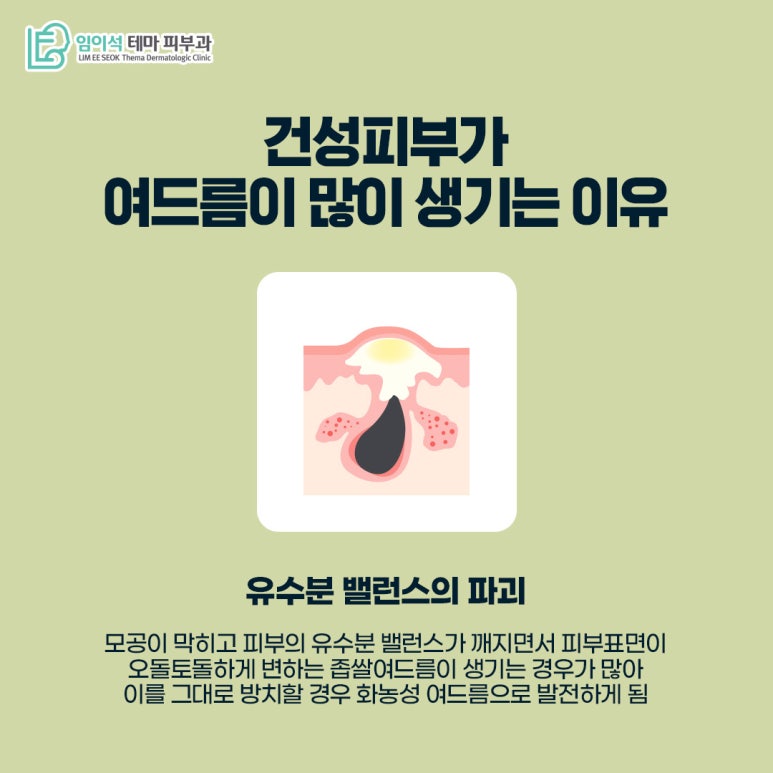임이석테마피부과 피부 타입별 여드름관리법 <건성피부편> 관련 이미지 5
