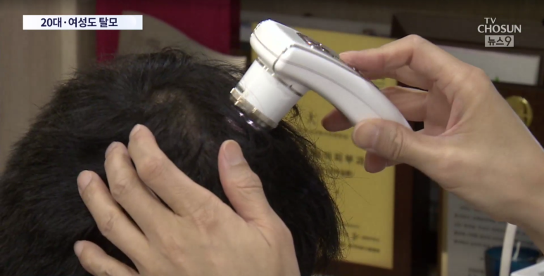 Director Im Yi-seok: "One in Four Hair Loss Patients Is in Their 20s or 30s" Appearance on TV Chosun News 9 image 3