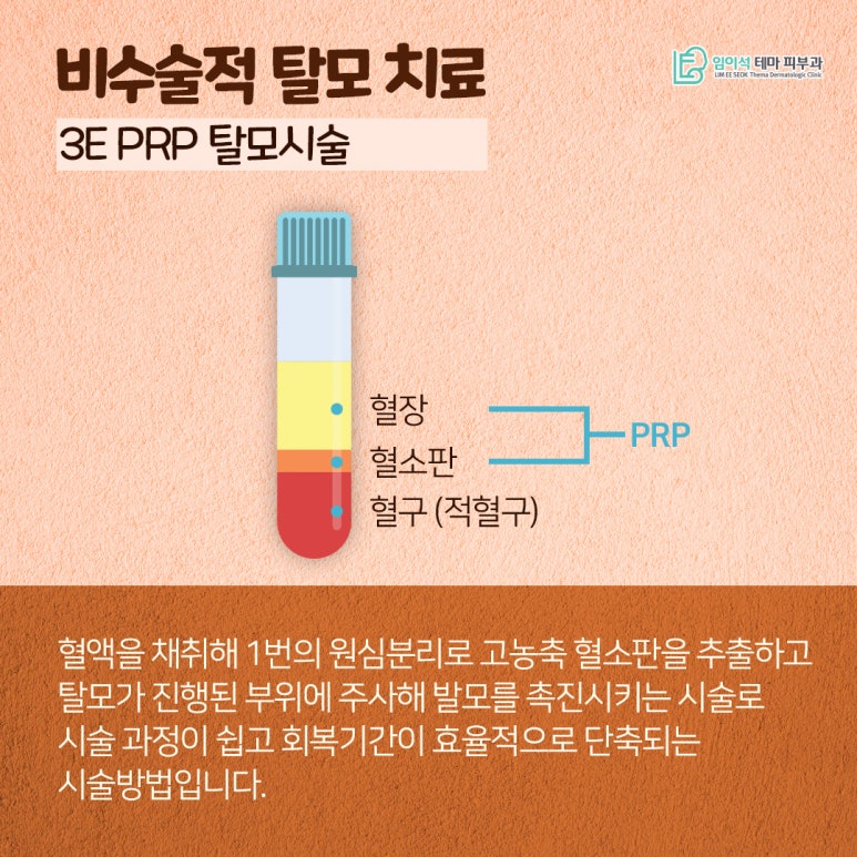 혹시, 나도 탈모일까? 신사피부과 탈모자가진단법 관련 이미지 9