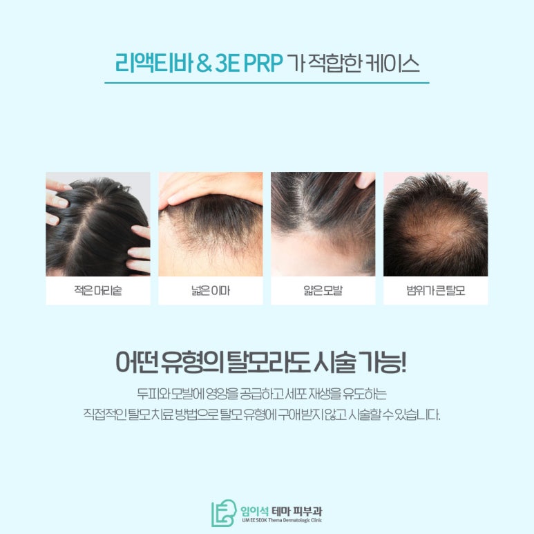 모발이식 없이 세포 재생 탈모치료 프로그램 관련 이미지 6