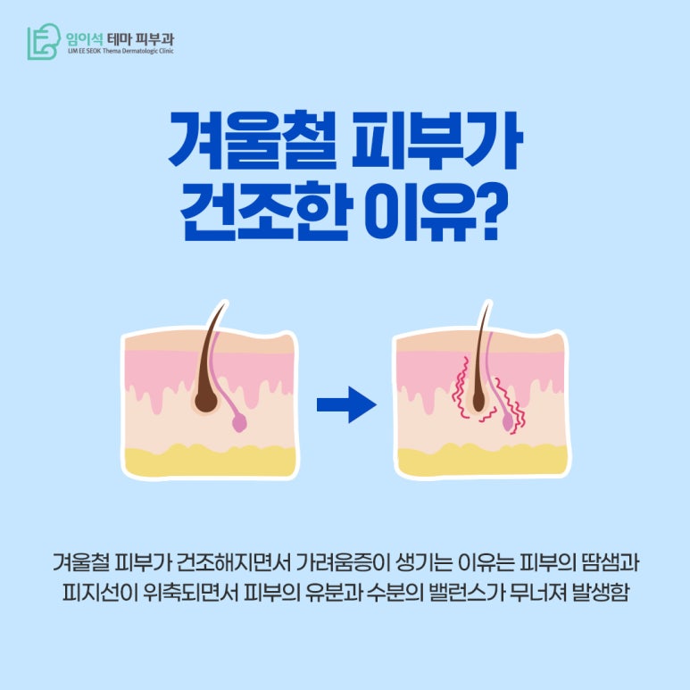 임이석테마피부과 춥고 건조한 겨울철에 생기는 피부 건조 관리 방법은? 관련 이미지 3