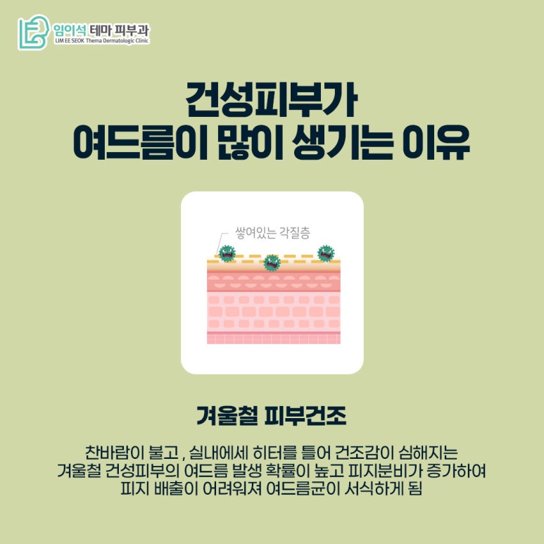 임이석테마피부과 피부 타입별 여드름관리법 <건성피부편> 관련 이미지 4