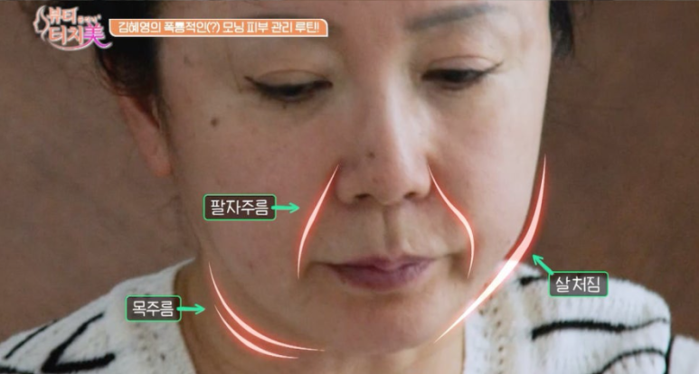 알콜스왑으로 얼굴 닦는 습관, 피부에 괜찮을까? ｜임이석테마피부과 임이석 대표원장 (채널A 뷰티클리닉 터치미 10화 김혜영편) 관련 이미지 3