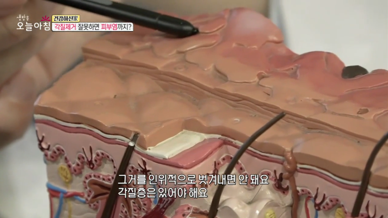 Director Im E-seok Appears on MBC's Live Morning Today, "Are You Healthy?" image 4