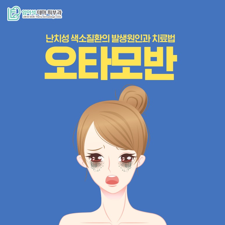 임이석피부과 오타모반, 난치성 색소질환의 발생 원인과 치료법 관련 이미지 2