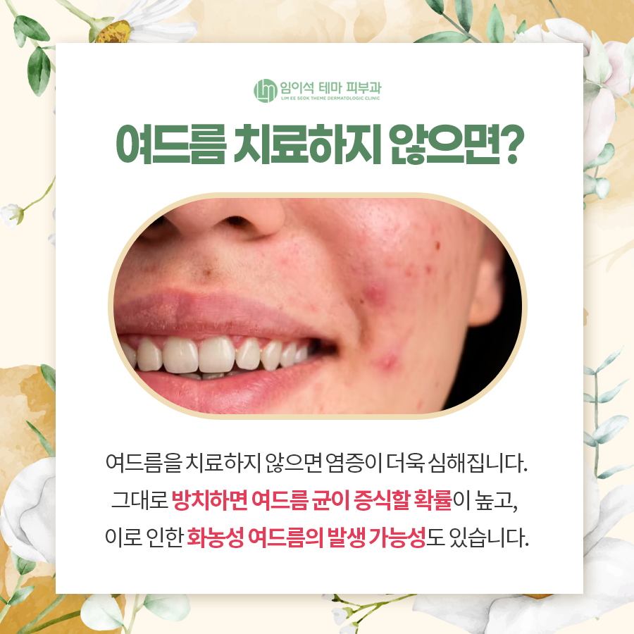 Effective Acne Treatment That Improves Sebaceous Glands image 5