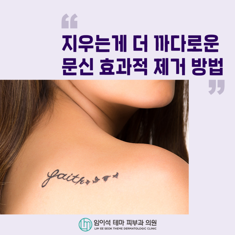 몸에 새긴 문신(타투) 제거 방법 관련 이미지 2