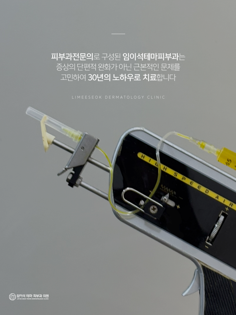 Are You Still Just Thinking About Hair Loss Treatment? (Imiseok Theme Dermatology) image 4