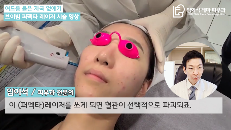 [임이석테마피부과 유튜브 Dr. 임이석 채널] 여드름 붉은 자국 없애는 관련 이미지 3